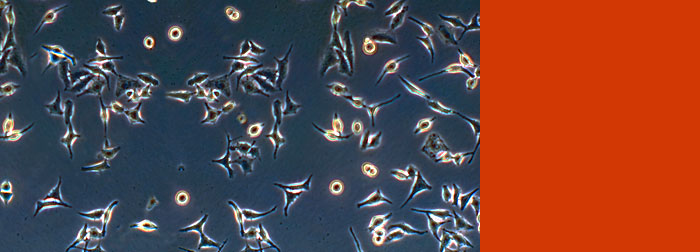New weapon in fight against cervical cancer