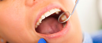 Novel treatment for early stage tooth decay