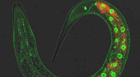 Signals from the nervous system and gut could prevent Alzheimer’s Disease