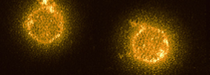 images/700_hpv_scan.jpg