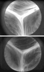 Figure 2: (EI)